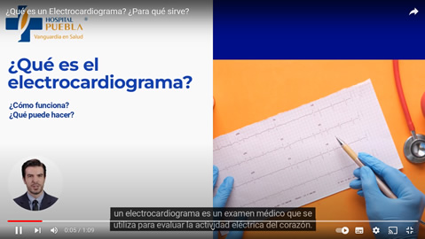 ¿Para qué sirve un electrocardiograma?