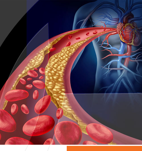 El Antes Síndrome Metabólico, y el Ahora Síndrome Cardio-Metabólico