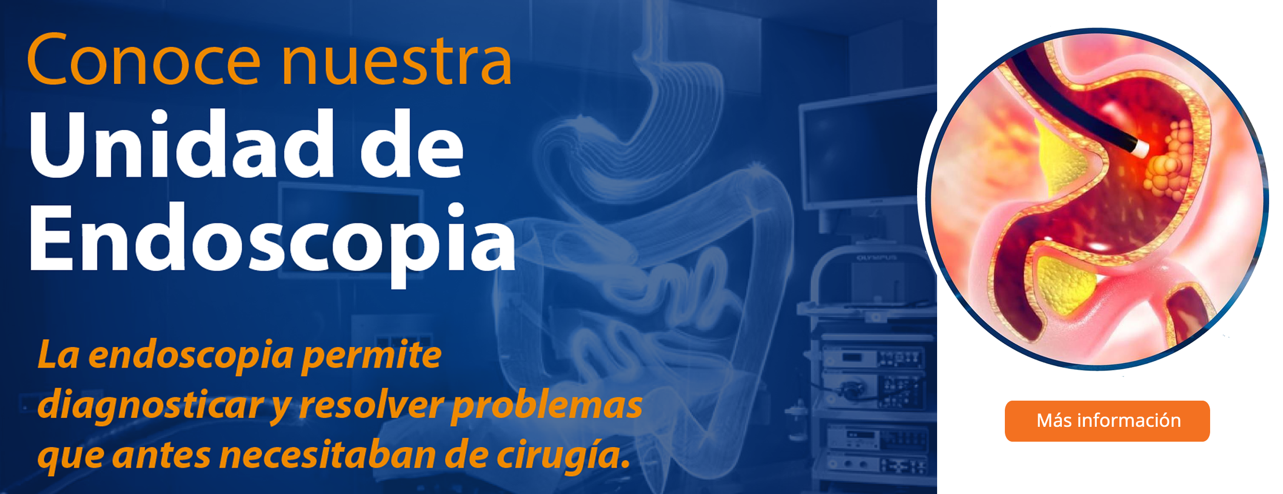 Endoscopia Hospital Puebla